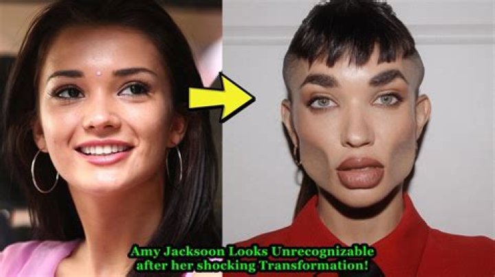Amy Jackson Plastic Surgery: Did She Really Go Under the Knife?