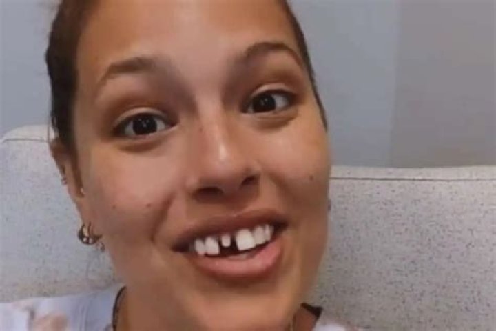 Ashley Graham Hilariously Shows Off Her Broken Tooth And New, Toothless Smile