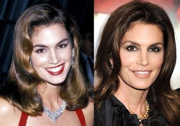 Cindy Crawford Plastic Surgery: An Open Admission of Opting Surgical Cosmetic Enhancements!