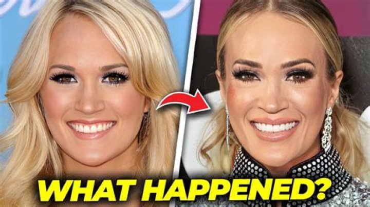 Dani Austin’s Plastic Surgery: Did The Influencer Have a Nose Job?