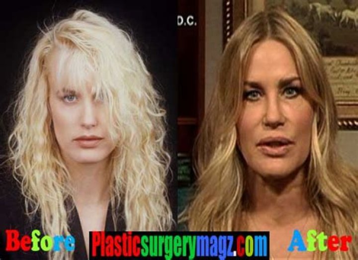 Daryl Hannah Plastic Surgery Before and After