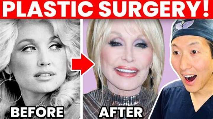 Did Monica Get Plastic Surgery? – Celebrity