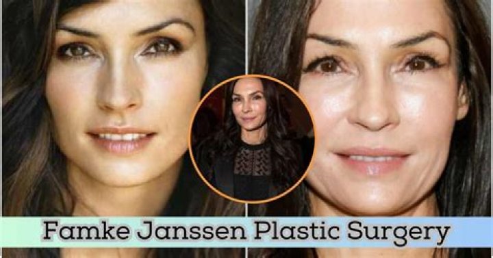 Famke Janssen Plastic Surgery Before and After