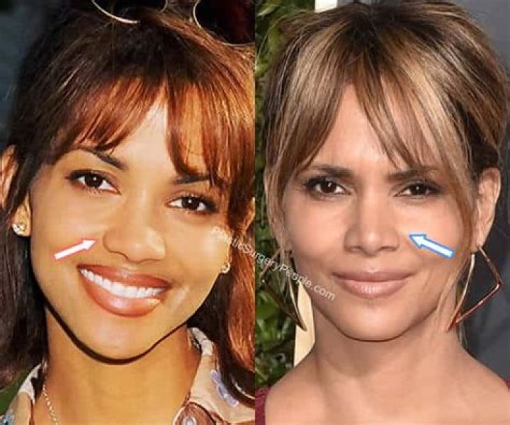 Halle Berry Nose Job Plastic Surgery Before and After
