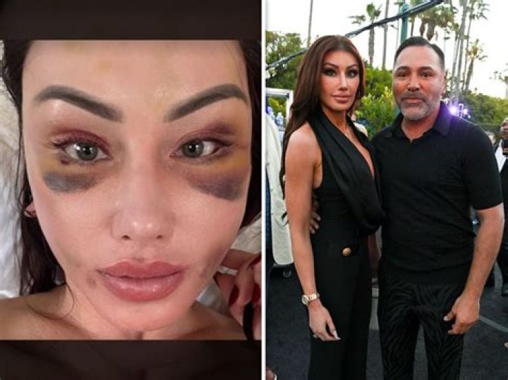 Holly Sonders Wiki, Plastic Surgery & Why She Divorced Her Husband – Erik Kuselias