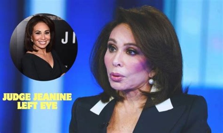 Judge Jeanine left eye: Does she have strabismus?