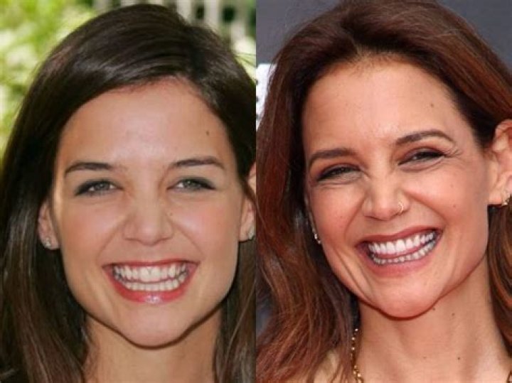 Katie Holmes Nose Job Plastic Surgery Before and After