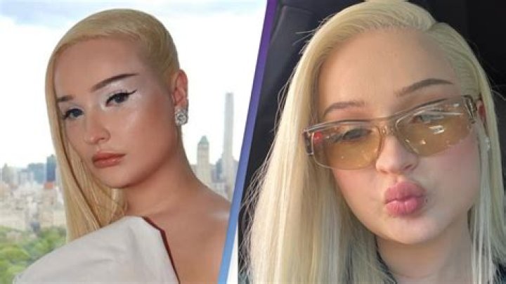 Kim Petras Plastic Surgery: Kim Petras Boldness and Respecting Personal Choices Revealed!