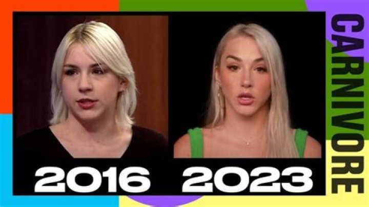 Mikhaila Peterson Plastic Surgery Truth: What You Need to Know