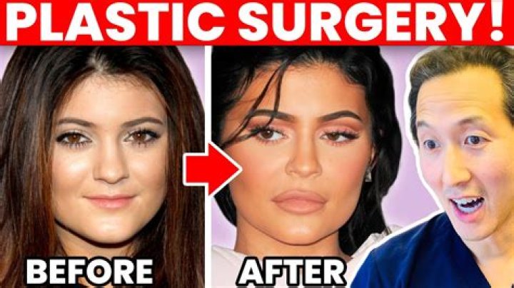 Mimi Keene Plastic Surgery: Did She Have Her Nose Job?