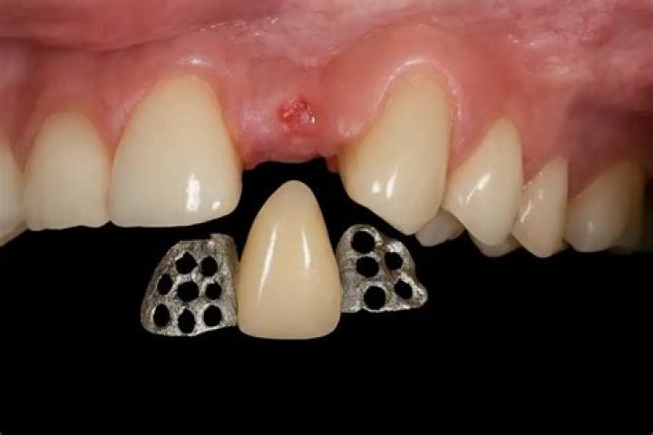 Dr. Monilla Dent, MD – Newport News, VA