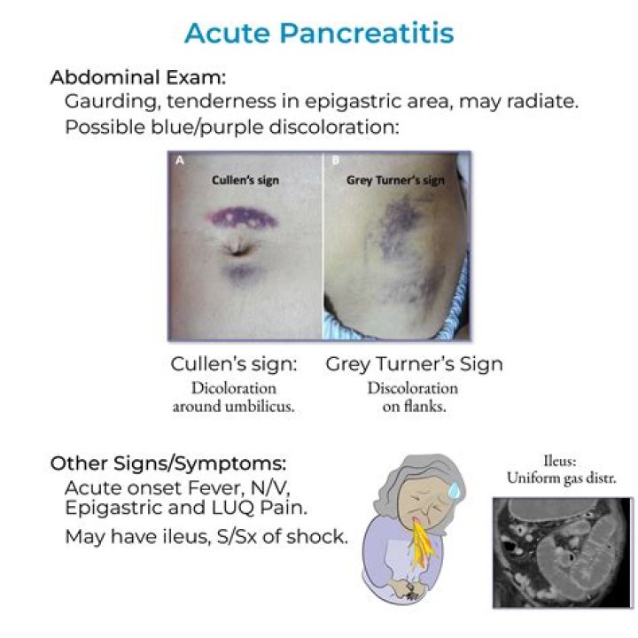 Rhiannon Storkamp Dies of Acute Pancreatitis