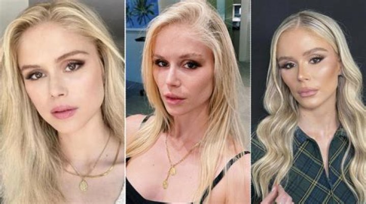 Teresa Palmer Plastic Surgery Before and After