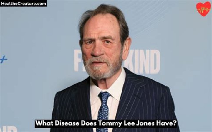 What disease does Tommy Lee Jones have?