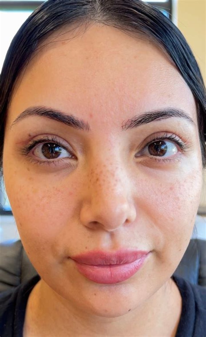 Dr. Umeng Thao, MD – Woodbury, MN